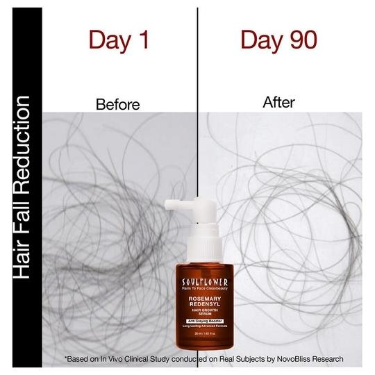 Soulflower Rosemary Redensyl Hair Growth Serum 30 ml