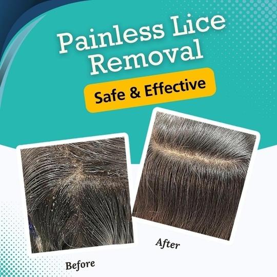 Head Lice Shampoo - Anti-Lice Shampoo - Lethal on Head Lice - Pack of 2