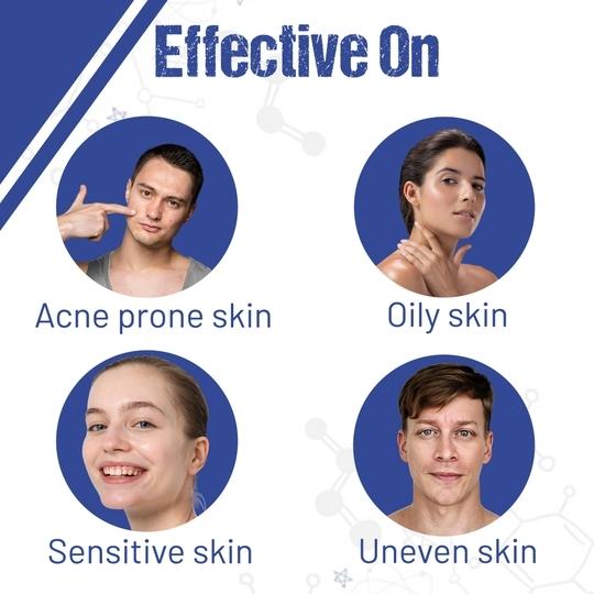 Healing Pharma - AcneTop Salicylic & Glycolic Acid Face Wash For Oily/Dry & Acne Prone Skin | Face Wash for Oil Control & Dirt Removal | Face Wash Fights Pollution, Blackheads & Pimples | Face Wash for Women and Men - 60ml